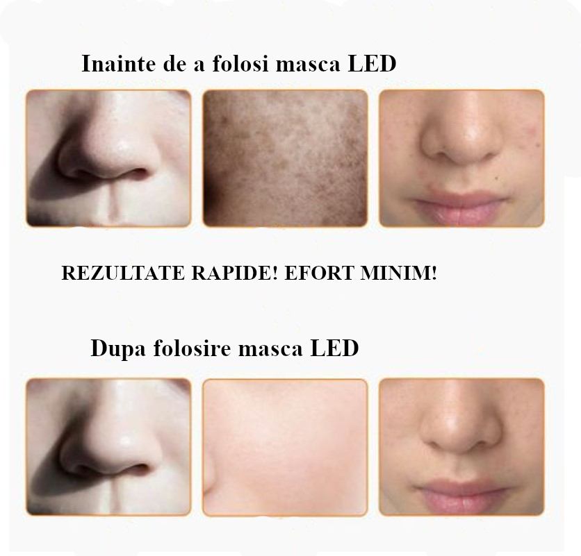 bag click Metal line Masca faciala cu led tratament afectiuni ten acnee pete riduri grasime 7 in  1 - eMAG.ro